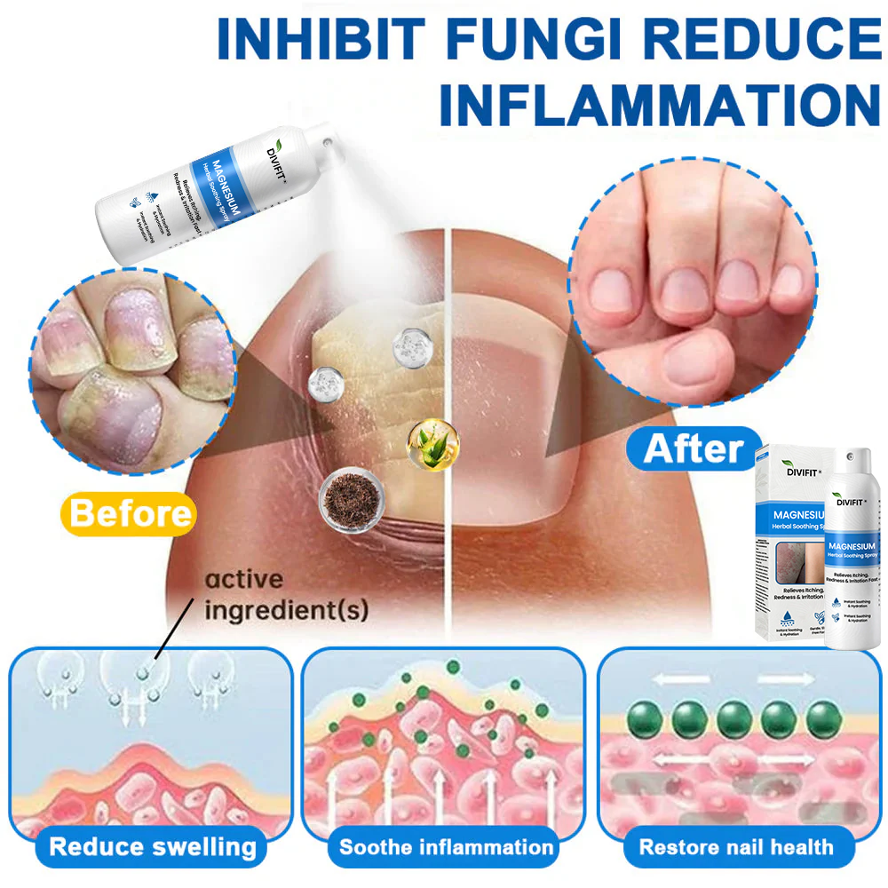 Divifit® Magnesium Herbal Psoriasis Spray