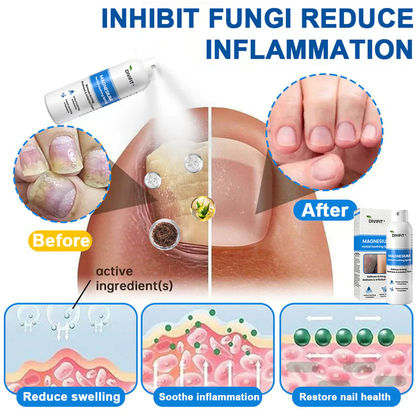 Divifit® Magnesium Herbal Psoriasis Spray