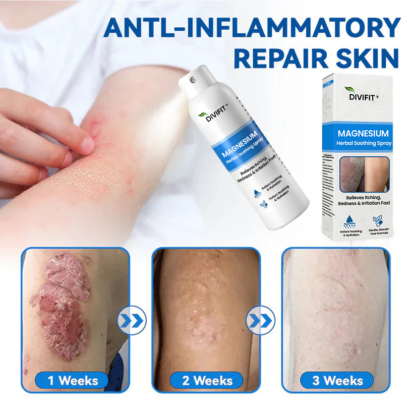 Divifit® Magnesium Herbal Psoriasis Spray