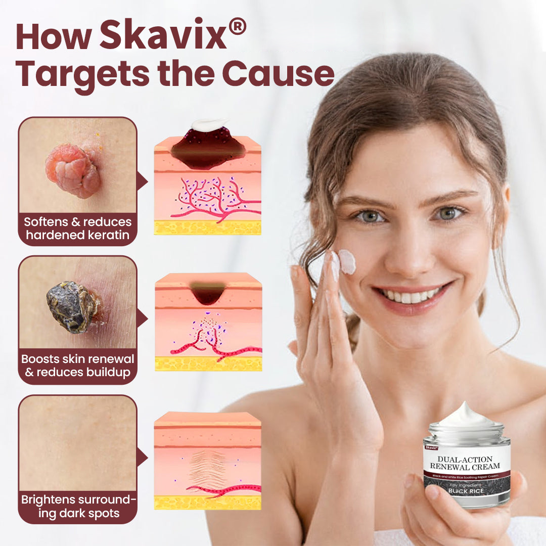 ✅Flash Sale - Skavix® Dual-Action Renewal Cream
